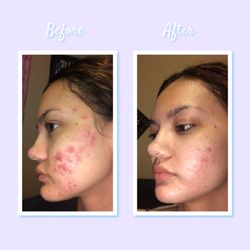 Skin by Fatima