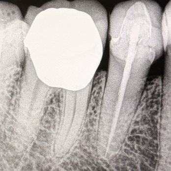 Iris Dental - Great Dental Work - Endodontists Near Me - Lemon Grove, California Iris Dental - Great Dental Work - Endodontists Near Me - Lemon Grove, California