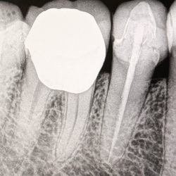 Iris Dental - Great Dental Work