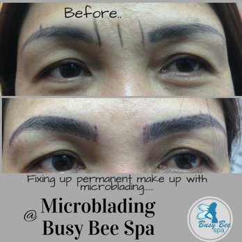 Busy Bee Spa - Laser Hair Removal Near Me - Toronto, Ontario