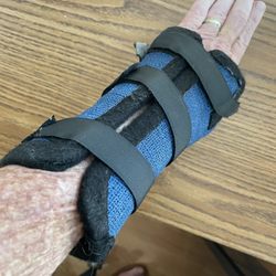 Fort Worth Physical Therapy - Removable cast from Fort Worth Physical Therapy, Mr. Patrick Kimball, Certified Hand Therapist.