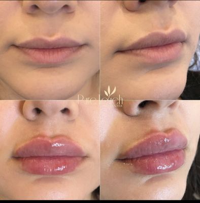 Pure Touch Skin Center 472 Photos 388 Reviews Skin Care 1014 E Colorado St Glendale Ca Phone Number Yelp