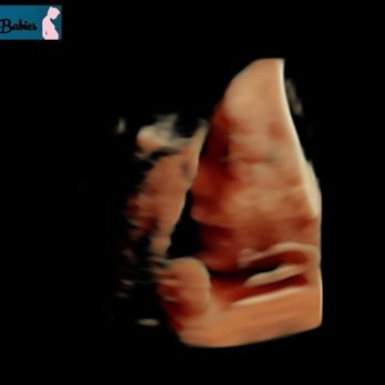 Barefoot Babies - Ultrasound Imaging Centers Near Me - Fayetteville, North Carolina Barefoot Babies - Ultrasound Imaging Centers Near Me - Fayetteville, North Carolina
