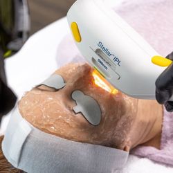 Skin - IPL Photofacial in Las Vegas