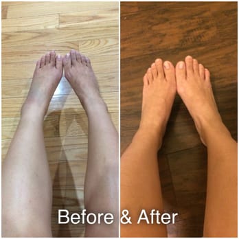 Richard S. Cheung, DC - 1 day after injury & as of now - Chiropractors Near Me - Pasadena, California Richard S. Cheung, DC - 1 day after injury & as of now - Chiropractors Near Me - Pasadena, California