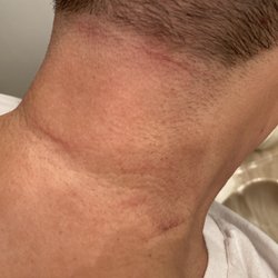 Cost Cutters - 3 days later, still swollen and very noticeable.