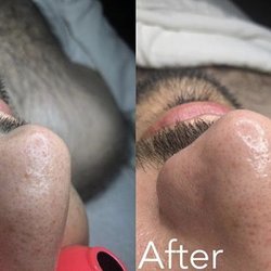 Exclusive Facials