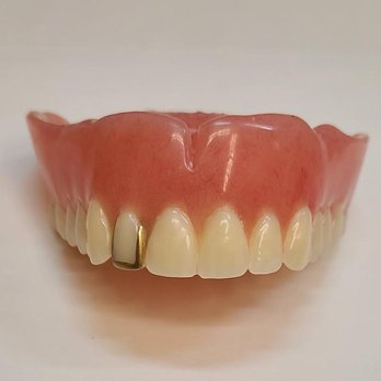 Aaron Denture Centre - Personalized Complete Upper Denture - Cosmetic Dentists Near Me - Edmonton, Alberta Aaron Denture Centre - Personalized Complete Upper Denture - Cosmetic Dentists Near Me - Edmonton, Alberta