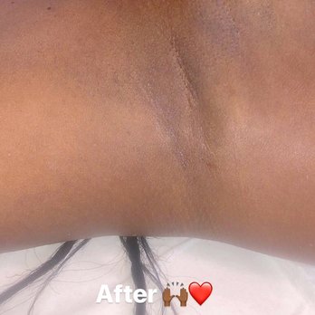 Flavours Spa Care - Wax Underarm Service - Skin Care Near Me - Dallas, Texas Flavours Spa Care - Wax Underarm Service - Skin Care Near Me - Dallas, Texas