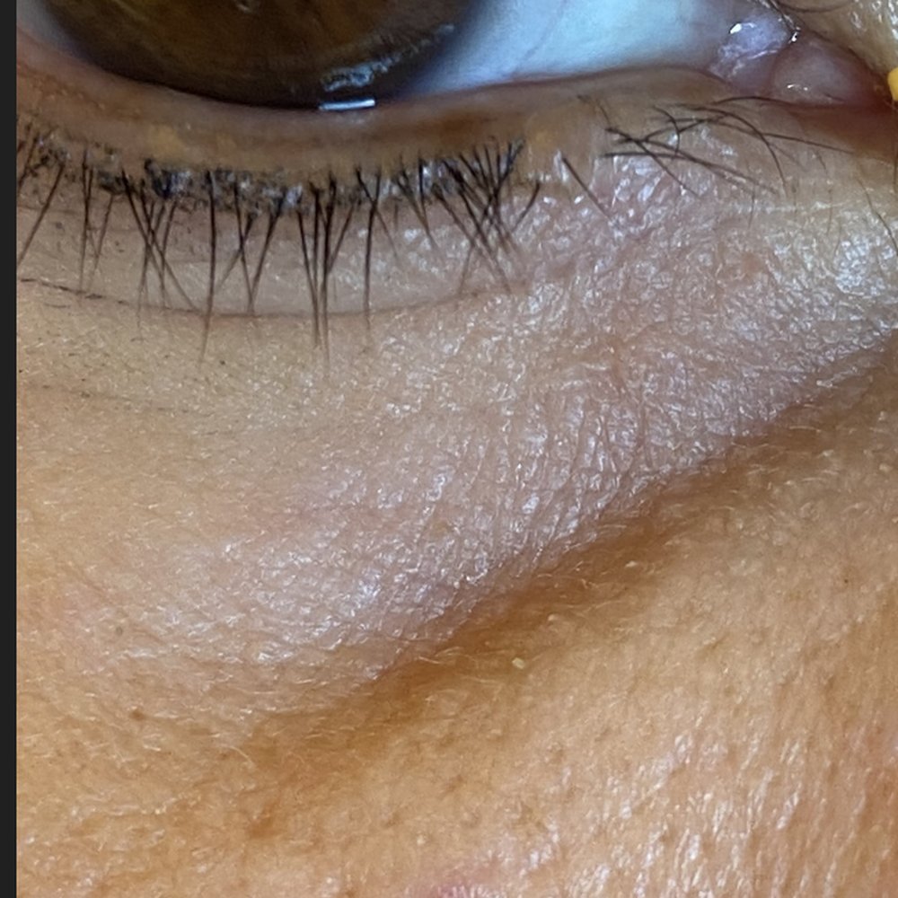 Ciocca Dermatology - Dermatologists Near Me - Miami, Florida Ciocca Dermatology - Dermatologists Near Me - Miami, Florida