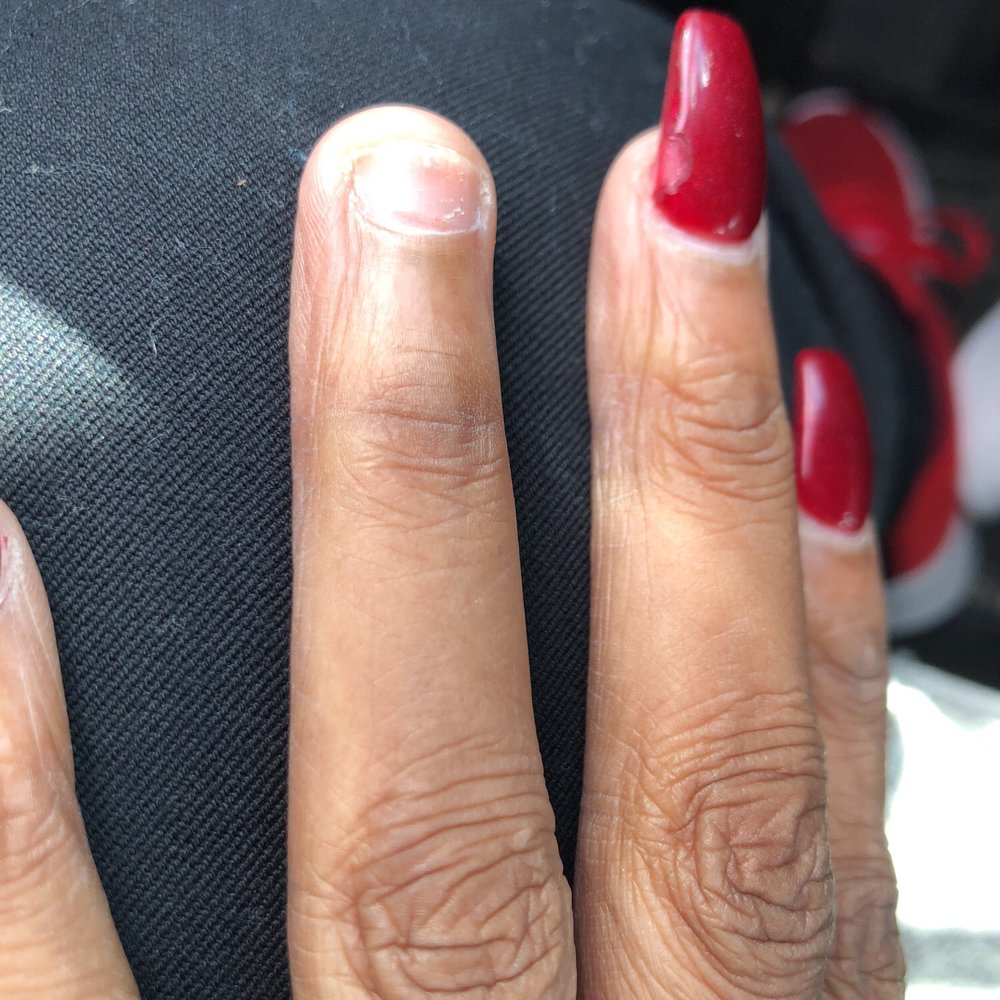 These are my nails after two days. The gel polish is cracked and a nail is gone. The other hand also has nail with polish issues. These are my nails after two days. The gel polish is cracked and a nail is gone. The other hand also has nail with polish issues.
