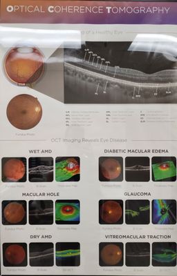 CSC OPTOMETRY - Updated June 2024 - 320 S Garfield Ave, Alhambra ...