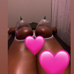 Infinity Beauty - Non-surgical Butt lift!