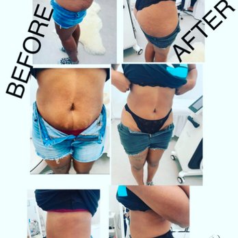 Glo'Up Body Spa - Glo'Up Body Spa - Body Contouring Near Me - Atlanta, Georgia Glo'Up Body Spa - Glo'Up Body Spa - Body Contouring Near Me - Atlanta, Georgia