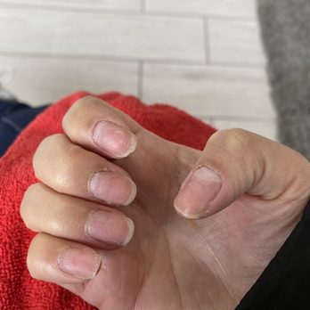 Top Coat Nail Spa - My ugly before nails! - Nail Salons Near Me - Chicago, Illinois Top Coat Nail Spa - My ugly before nails! - Nail Salons Near Me - Chicago, Illinois