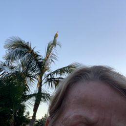 Use sunscreen Use sunscreen