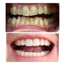 Sugarloaf Smiles - February 2025 to February 2026!