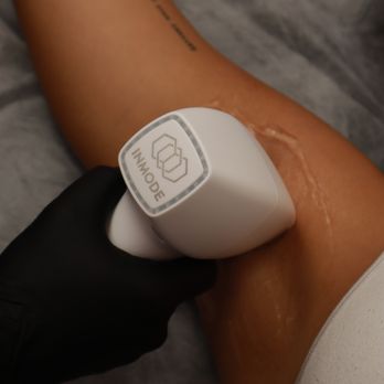 Xcellence Wellness and Aesthetics - Get rid of the razor and Say Hello to Smoother Skin with our Laser Hair Removal Packages
Call today and schedule your appointment - Aestheticians Near Me - Miami Lakes, Florida Xcellence Wellness and Aesthetics - Get rid of the razor and Say Hello to Smoother Skin with our Laser Hair Removal Packages
Call today and schedule your appointment - Aestheticians Near Me - Miami Lakes, Florida