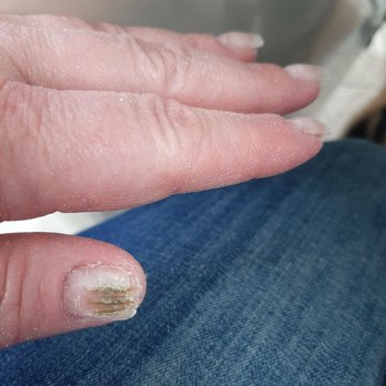 Cherry Nail & Spa - They new salon couldn't even replace my thumb nail because all the lifting caused fungus. - Nail Salons Near Me - Fontana, California Cherry Nail & Spa - They new salon couldn't even replace my thumb nail because all the lifting caused fungus. - Nail Salons Near Me - Fontana, California