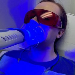 The Glam Squad - Teeth whitening