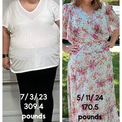 Central California Surgery - My highest weight versus my current weight