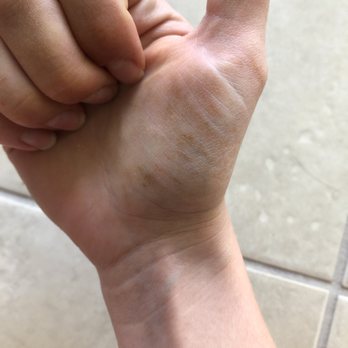 Spavia Day Spa - Boulder - Spray tan blotches on my hands after exfoliating to try to get off - Day Spas Near Me - Boulder, Colorado