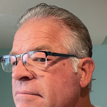 Dermaclinique - Pre MOHS surgery - Dermatologists Near Me - St. Petersburg, Florida