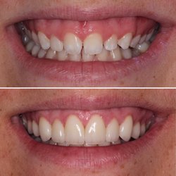 Jared B  Williams, DDS - Veneers, Crowns, Smile Makeover
