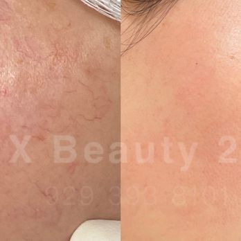 X Beauty 29 - Skin Care Near Me - Flushing, New York