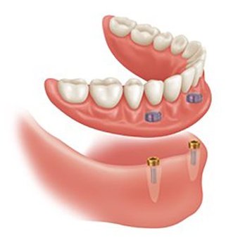 Smile Zone Denture Clinic - General Dentistry Near Me - Richmond, British Columbia Smile Zone Denture Clinic - General Dentistry Near Me - Richmond, British Columbia