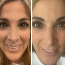 advanced skincare medcenter