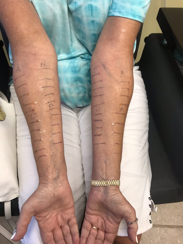 ASTHMA & ALLERGY ASSOCIATES OF FLA Updated August 2024 2021 E Commercial Blvd, Fort