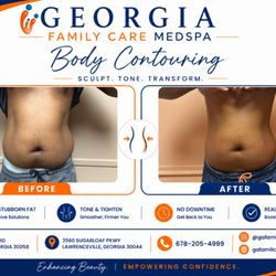 Georgia Family Care - Shape and sculpt your body with body contouring in Lithonia. Target stubborn areas with non-invasive treatments.