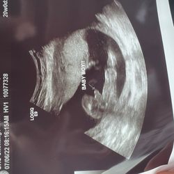 UHS Chenango Memorial Hospital - Our Baby Boy