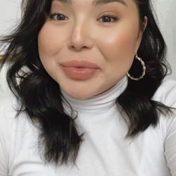 *Cheeks *Chin *Botox *lips