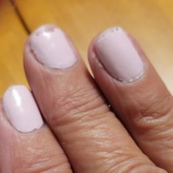 One day post manicure.