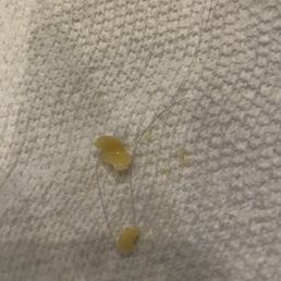Hair in my food Hair in my food