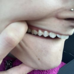 Moormann J Andrew, DDS