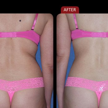 Laser East Med Spa - Medical Spas Near Me - Commack, New York
