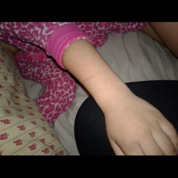 Escalona Elementary School - My poor girl! - Elementary Schools Near Me - La Mirada, California