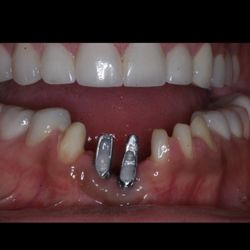 Rubenstein Dental Group