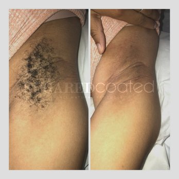 SugaredCoated - Sugared UnderArm - Sugaring Near Me - Southfield, Michigan SugaredCoated - Sugared UnderArm - Sugaring Near Me - Southfield, Michigan