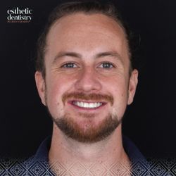 Esthetic Dentistry Puerto Vallarta - Smile face!