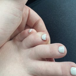 Cut my toe Cut my toe