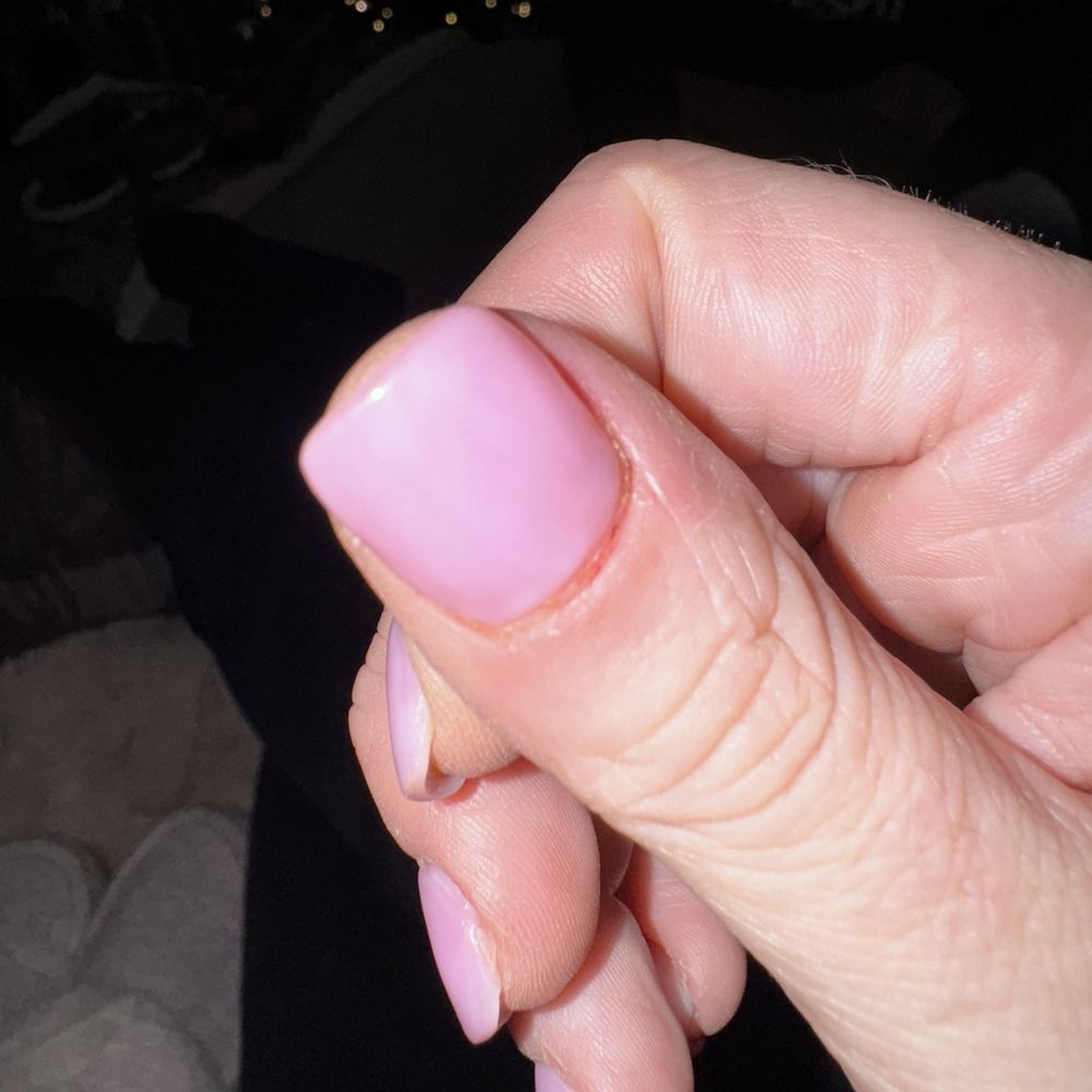 Glitz Nail & Lashes - Deep cut cuticle - Nail Salons Near Me - Meridian, Idaho Glitz Nail & Lashes - Deep cut cuticle - Nail Salons Near Me - Meridian, Idaho