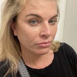 Haus of Marin - No makeup. Very natural look, Jen really really helped with my brown spots from the sun with her top of the line Sciton lasers.