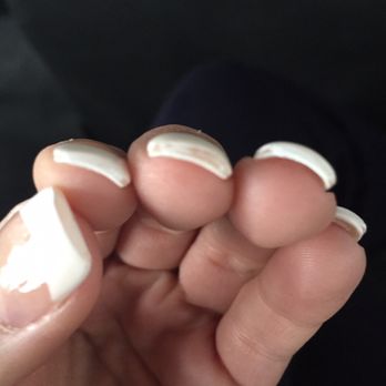 VIP Nails & Spa - This was after I went to another salon for a quick polish, look at how thick they are!! - Day Spas Near Me - Dallas, Texas VIP Nails & Spa - This was after I went to another salon for a quick polish, look at how thick they are!! - Day Spas Near Me - Dallas, Texas