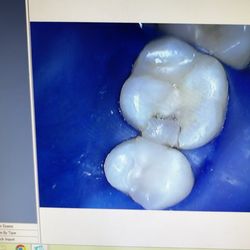 A+ Dental - Before