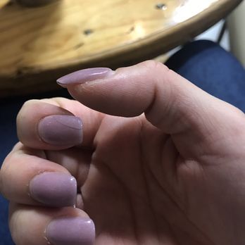 Super Nails - Cracked nails and on the edge of thumb - Nail Salons Near Me - Nashville, Tennessee Super Nails - Cracked nails and on the edge of thumb - Nail Salons Near Me - Nashville, Tennessee
