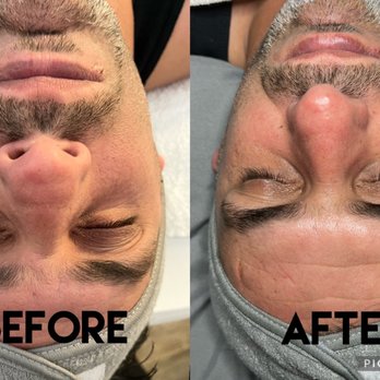 Bare Haven Wax Studio - Men's facial - Waxing Near Me - Upland, California Bare Haven Wax Studio - Men's facial - Waxing Near Me - Upland, California